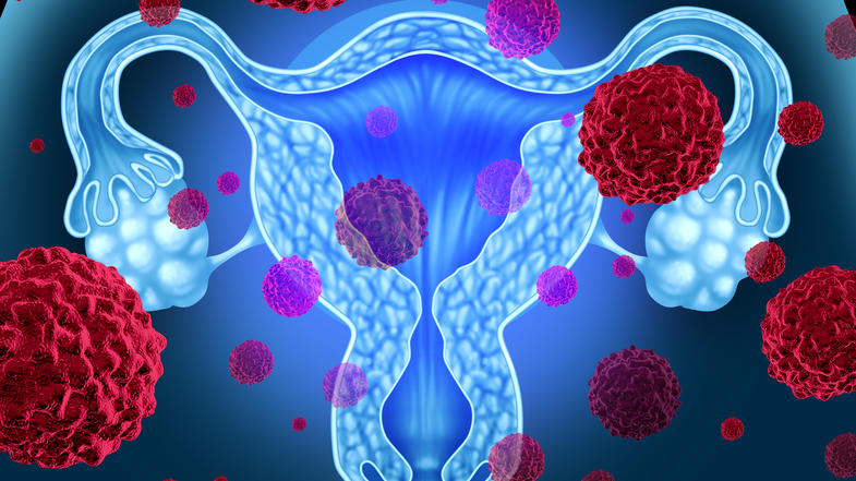 different types of uterine cancer